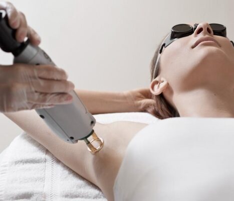 Debunking myths surrounding laser hair removal